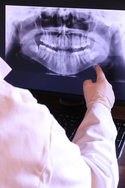Best Knocked-Out Tooth (Avulsed Tooth) Treatment in Salamatof, AK