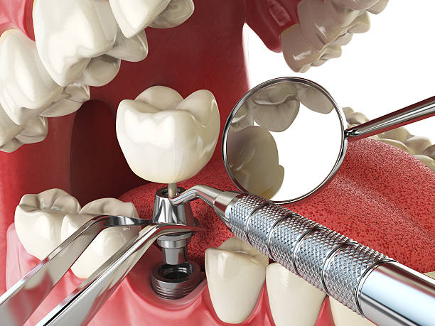 Best Emergency Orthodontic Repairs in Salamatof, AK